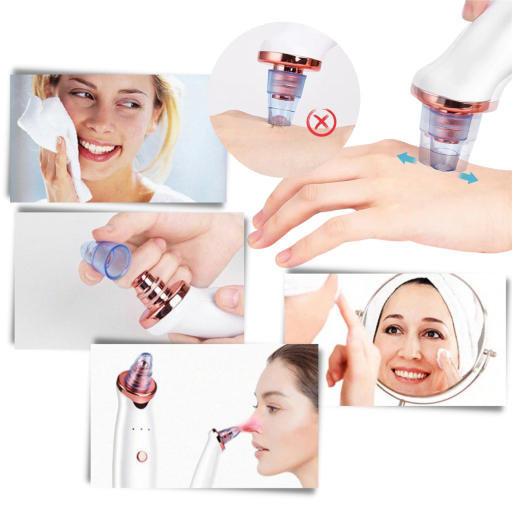 Blackhead Pore Remover Vacuum