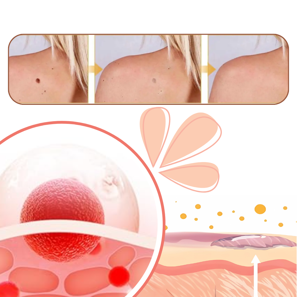 Non-Invasive Tag Recede - Ozerty